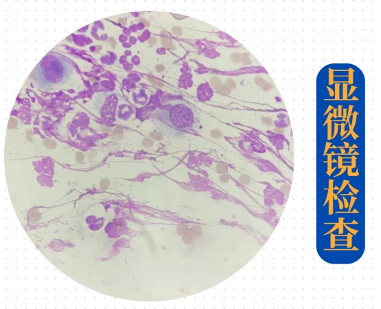 怎么判断猫癣