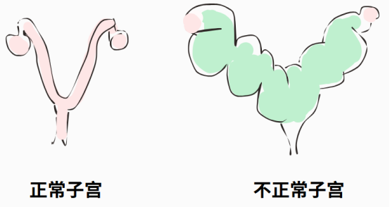 狗狗子宫蓄脓症状
