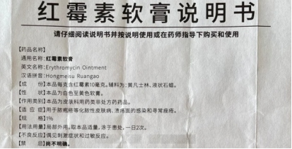 红霉素治猫癣可以治猫癣吗
