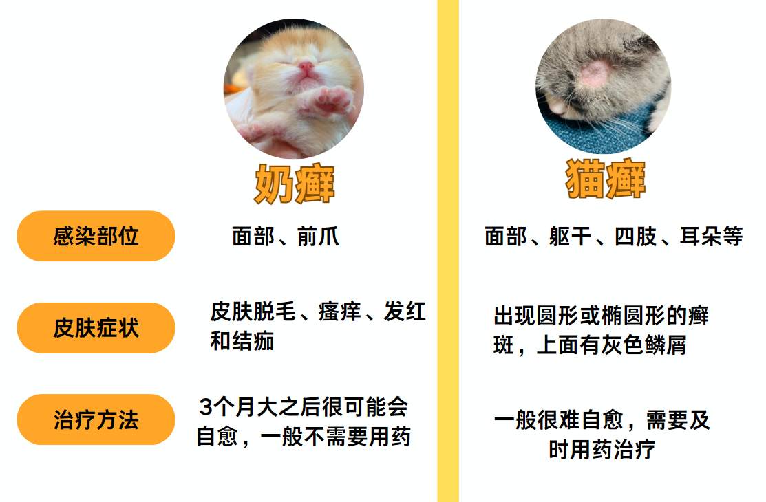 奶癣和猫癣有什么区别