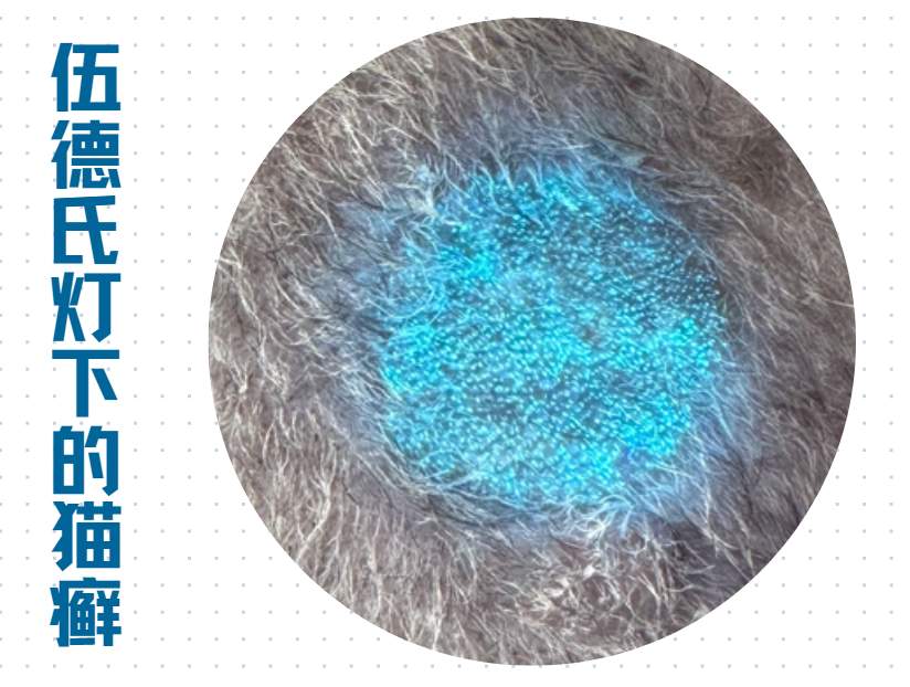 伍德氏灯查猫癣准吗?