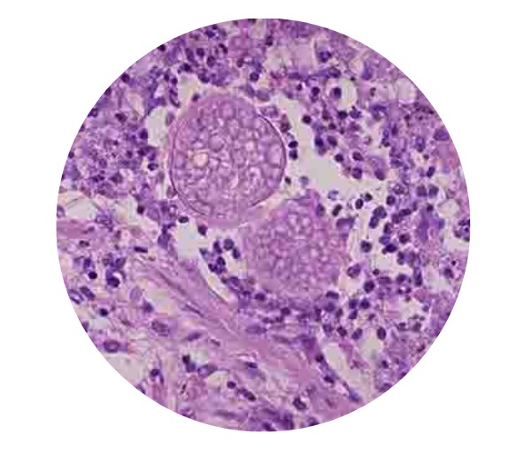 猫癣是什么原因导致的?