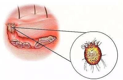 狗狗感染疥癣难根治?或许是方法不对