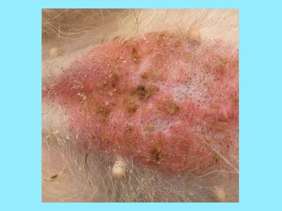 狗狗肚皮上有红疙瘩用什么药?